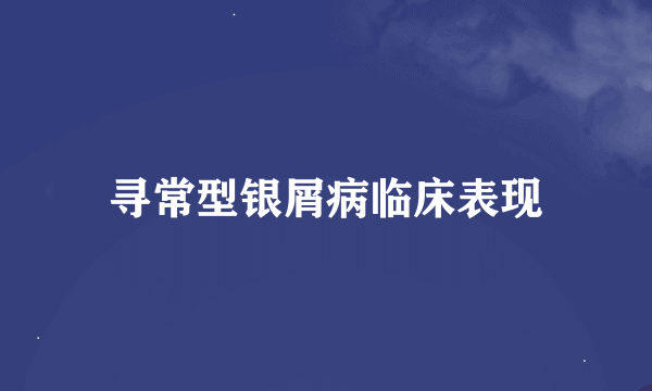 寻常型银屑病临床表现
