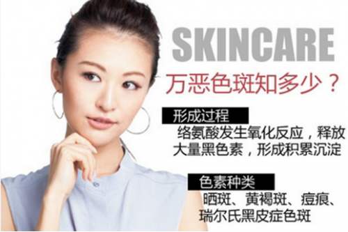 产后的黄褐斑该怎么去除