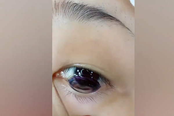 美瞳怎么戴