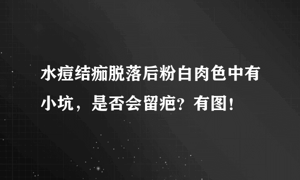 水痘结痂脱落后粉白肉色中有小坑，是否会留疤？有图！
