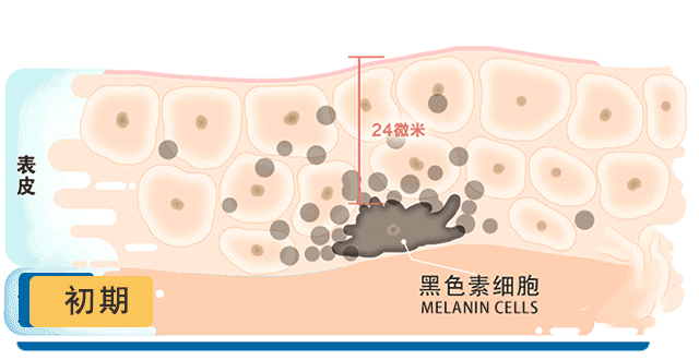 薇姿淡斑精华怎么样？