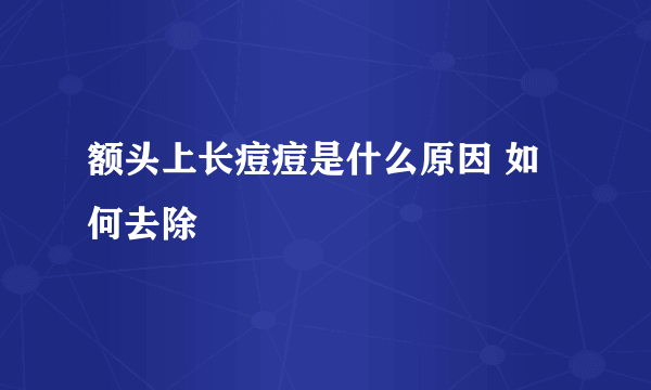 额头上长痘痘是什么原因 如何去除