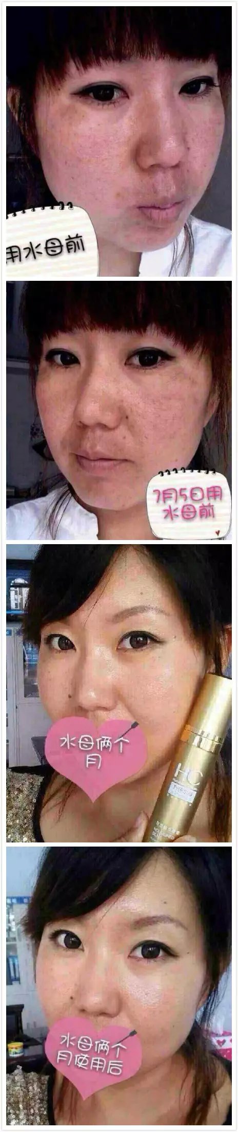 有什么面膜可以去斑？